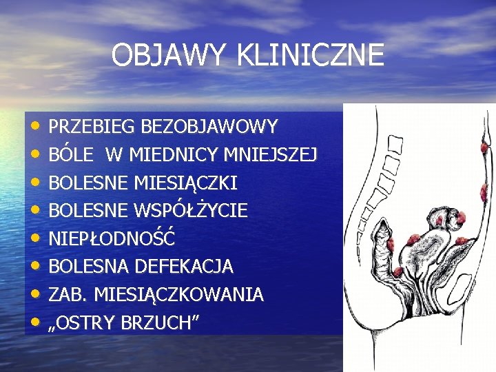 OBJAWY KLINICZNE • PRZEBIEG BEZOBJAWOWY • BÓLE W MIEDNICY MNIEJSZEJ • BOLESNE MIESIĄCZKI •