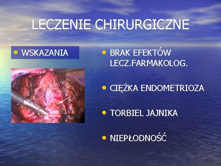 LECZENIE CHIRURGICZNE • WSKAZANIA • BRAK EFEKTÓW LECZ. FARMAKOLOG. • CIĘŻKA ENDOMETRIOZA • TORBIEL