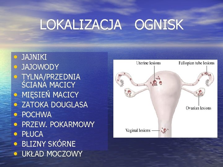 LOKALIZACJA OGNISK • JAJNIKI • JAJOWODY • TYLNA/PRZEDNIA • • ŚCIANA MACICY MIĘSIEŃ MACICY