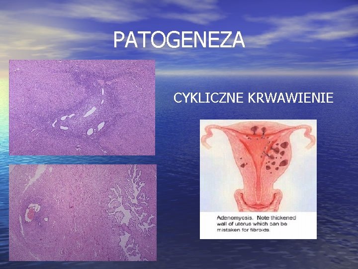 PATOGENEZA CYKLICZNE KRWAWIENIE 