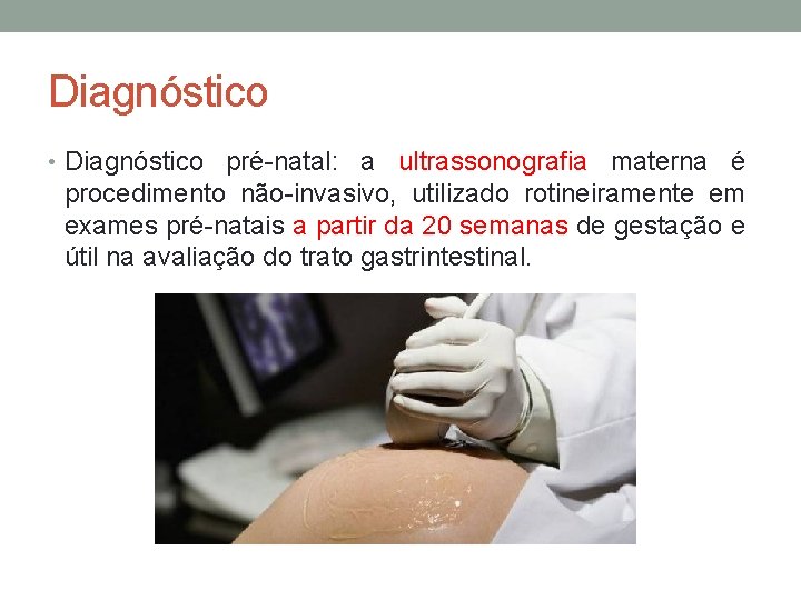 Diagnóstico • Diagnóstico pré-natal: a ultrassonografia materna é procedimento não-invasivo, utilizado rotineiramente em exames