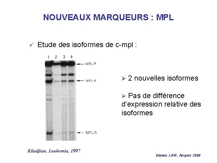NOUVEAUX MARQUEURS : MPL ü Etude des isoformes de c-mpl : Ø 2 nouvelles