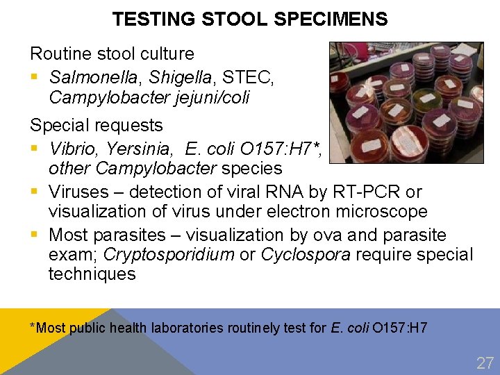 TESTING STOOL SPECIMENS Routine stool culture § Salmonella, Shigella, STEC, Campylobacter jejuni/coli Special requests