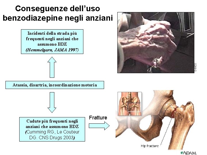Conseguenze dell’uso benzodiazepine negli anziani Incidenti della strada più frequenti negli anziani che assumono