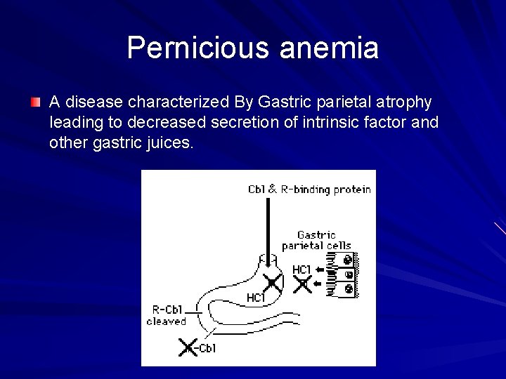 Pernicious anemia A disease characterized By Gastric parietal atrophy leading to decreased secretion of