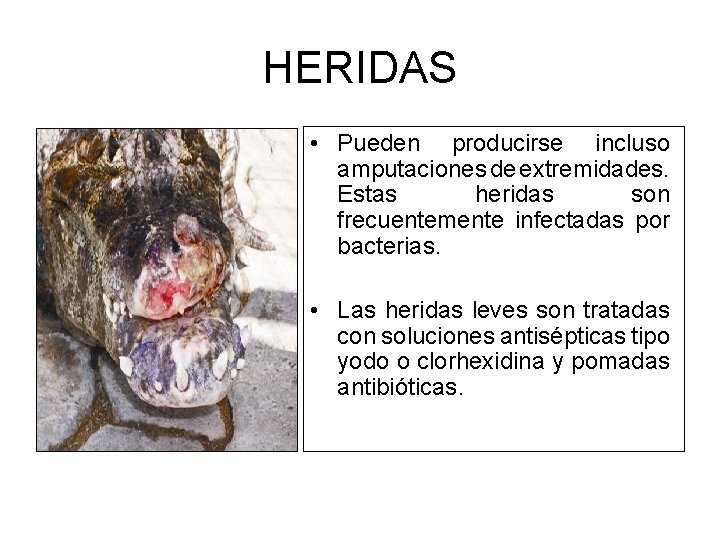 HERIDAS • Pueden producirse incluso amputaciones de extremidades. Estas heridas son frecuentemente infectadas por