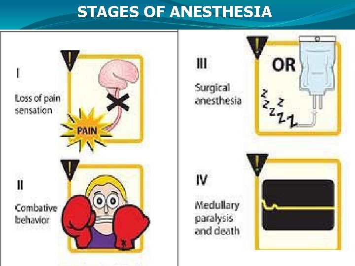 STAGES OF ANESTHESIA 