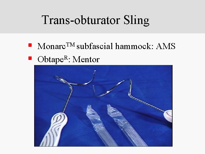 Trans-obturator Sling § Monarc. TM subfascial hammock: AMS § Obtape. R: Mentor 
