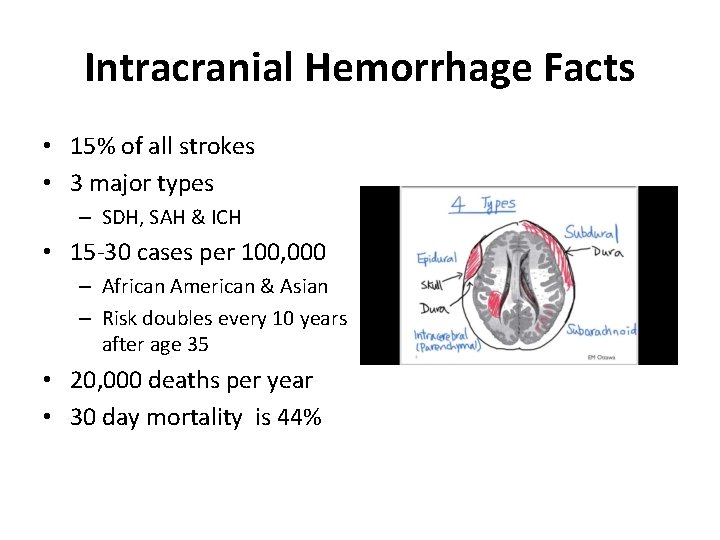 Intracranial Hemorrhage Facts • 15% of all strokes • 3 major types – SDH,