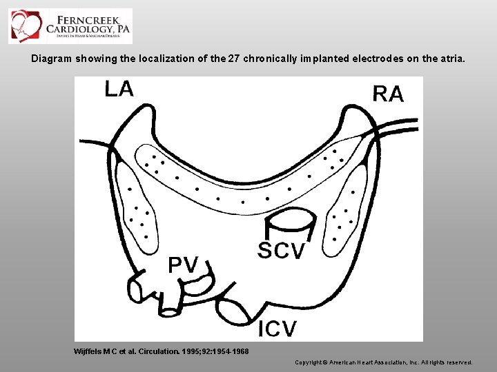 Diagram showing the localization of the 27 chronically implanted electrodes on the atria. Wijffels
