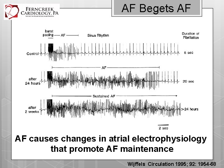 AF Begets AF AF causes changes in atrial electrophysiology that promote AF maintenance Wijffels
