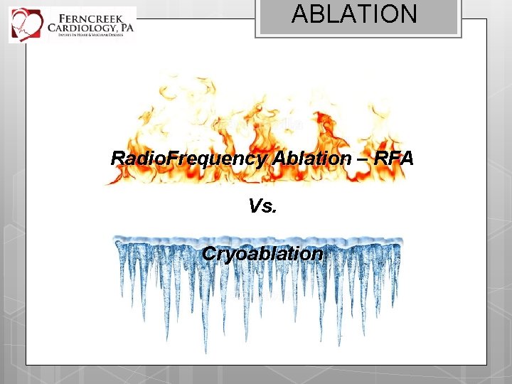 ABLATION Radio. Frequency Ablation – RFA Vs. Cryoablation 