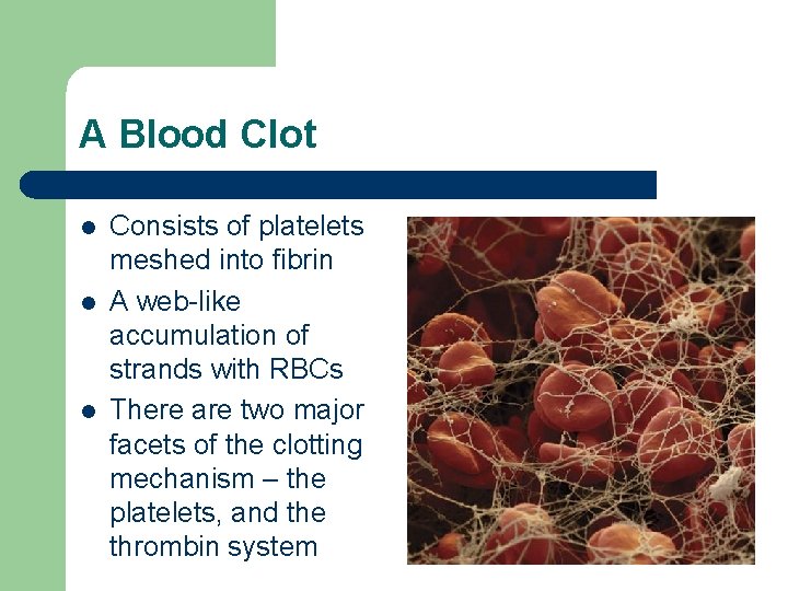 A Blood Clot l l l Consists of platelets meshed into fibrin A web-like