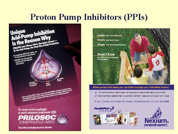 Proton Pump Inhibitors (PPIs) 