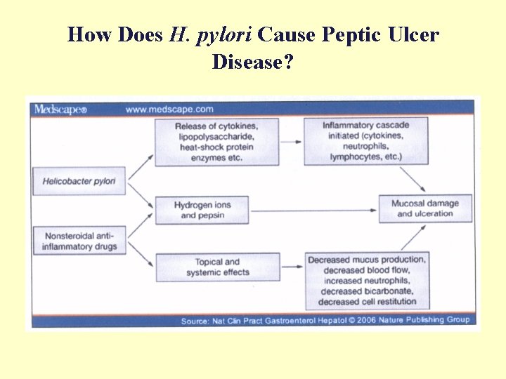 How Does H. pylori Cause Peptic Ulcer Disease? 