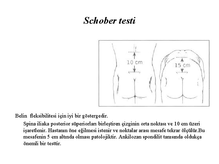 Schober testi Belin fleksibilitesi için iyi bir göstergedir. Spina iliaka posterior süperiorları birleştiren çizginin