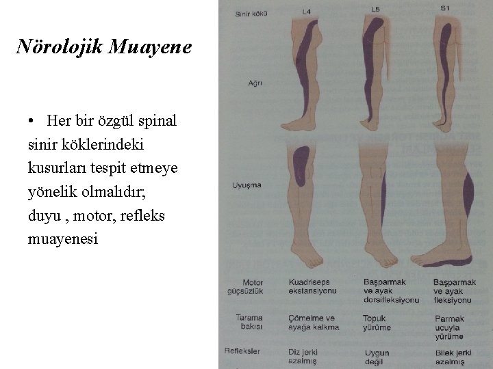 Nörolojik Muayene • Her bir özgül spinal sinir köklerindeki kusurları tespit etmeye yönelik olmalıdır;