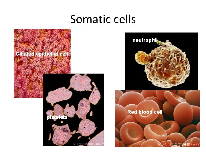 Somatic cells neutrophil Ciliated epithelial cell platelets Red blood cell 