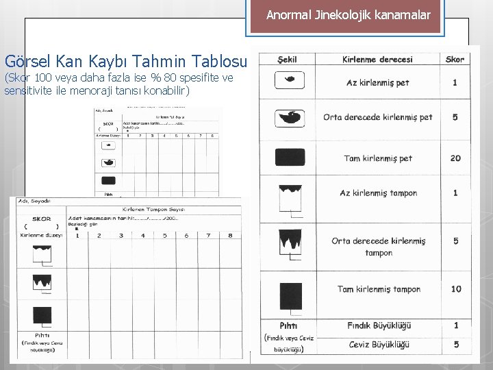 Anormal Jinekolojik kanamalar Görsel Kan Kaybı Tahmin Tablosu (Skor 100 veya daha fazla ise