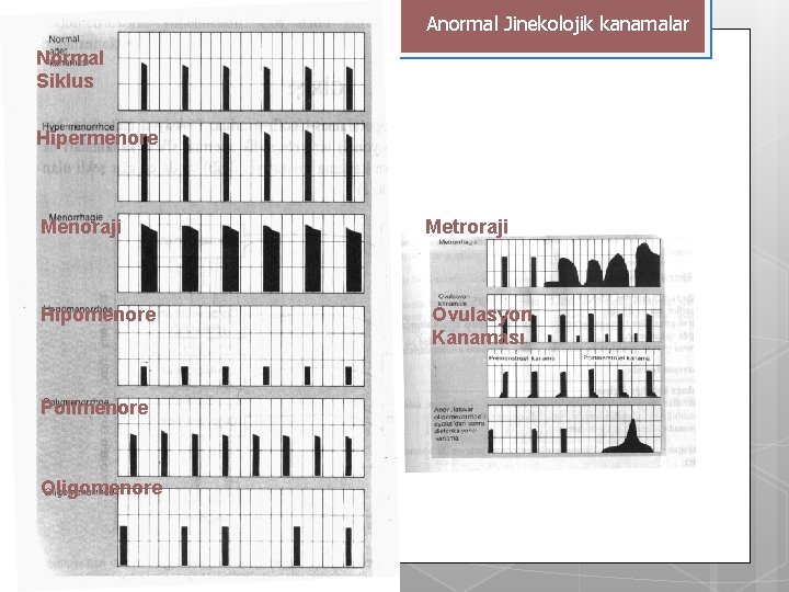 Anormal Jinekolojik kanamalar Normal Siklus Hipermenore Menoraji Hipomenore Polimenore Oligomenore Metroraji Ovulasyon Kanaması 