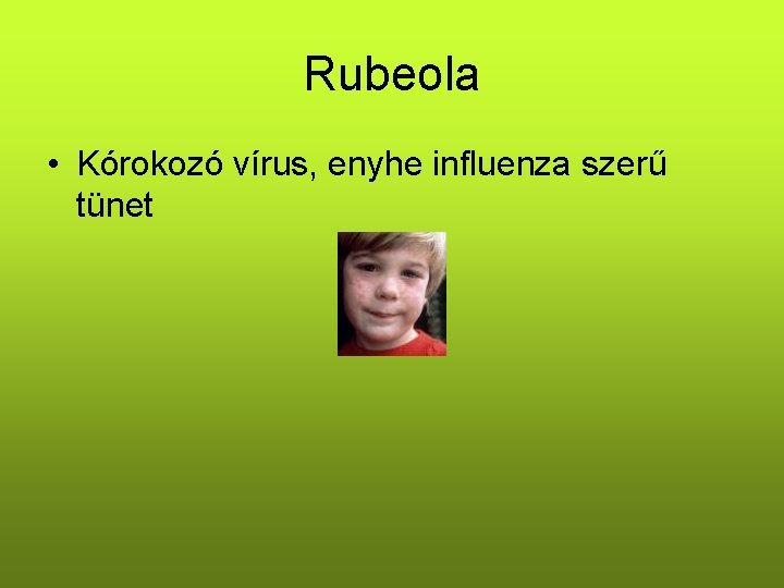 Rubeola • Kórokozó vírus, enyhe influenza szerű tünet 