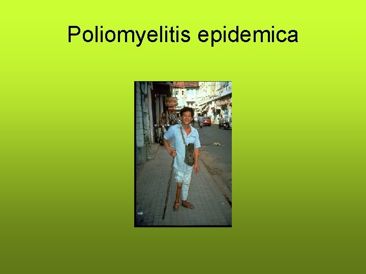 Poliomyelitis epidemica 