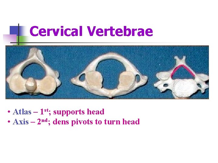 Cervical Vertebrae • Atlas – 1 st; supports head • Axis – 2 nd;