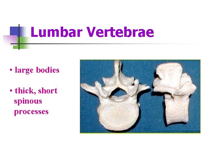 Lumbar Vertebrae • large bodies • thick, short spinous processes 