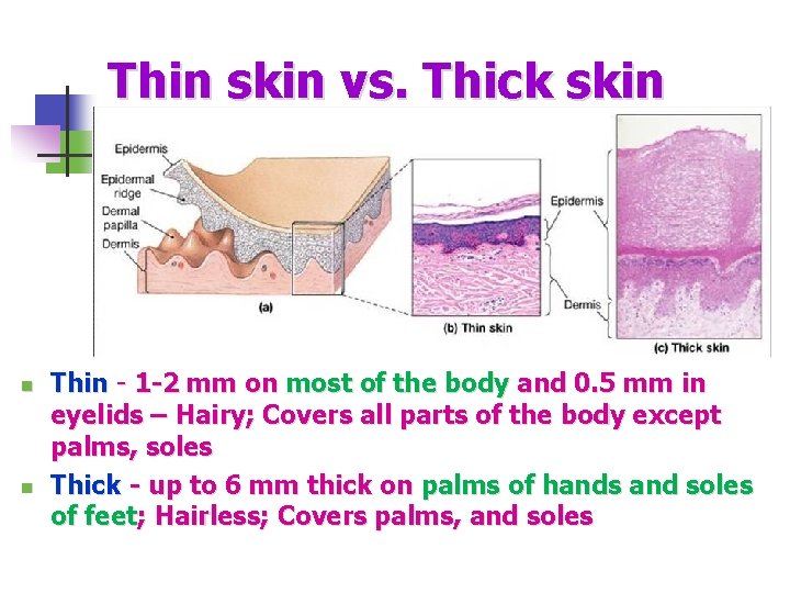 Thin skin vs. Thick skin n n Thin - 1 -2 mm on most