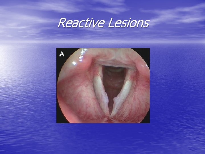 Reactive Lesions 