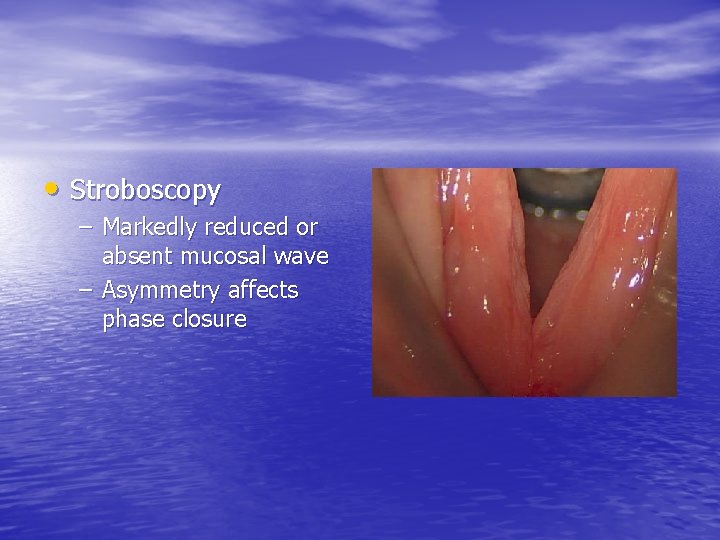  • Stroboscopy – Markedly reduced or absent mucosal wave – Asymmetry affects phase