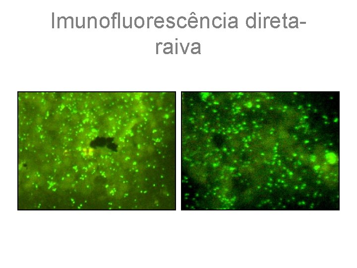 Imunofluorescência diretaraiva 