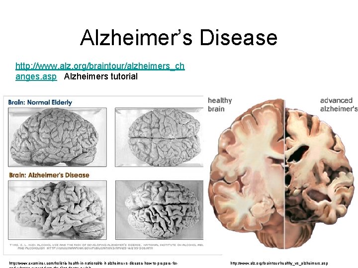 Alzheimer’s Disease http: //www. alz. org/braintour/alzheimers_ch anges. asp Alzheimers tutorial http: //www. examiner. com/holistic-health-in-national/is-it-alzheimer-s-disease-how-to-prepare-for-