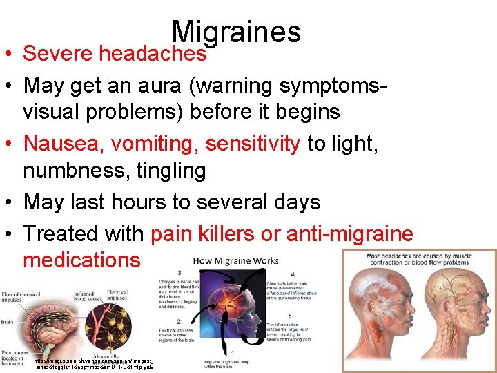 Migraines • Severe headaches • May get an aura (warning symptomsvisual problems) before it