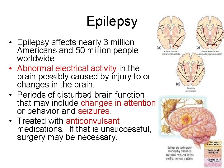 Epilepsy • Epilepsy affects nearly 3 million Americans and 50 million people worldwide •