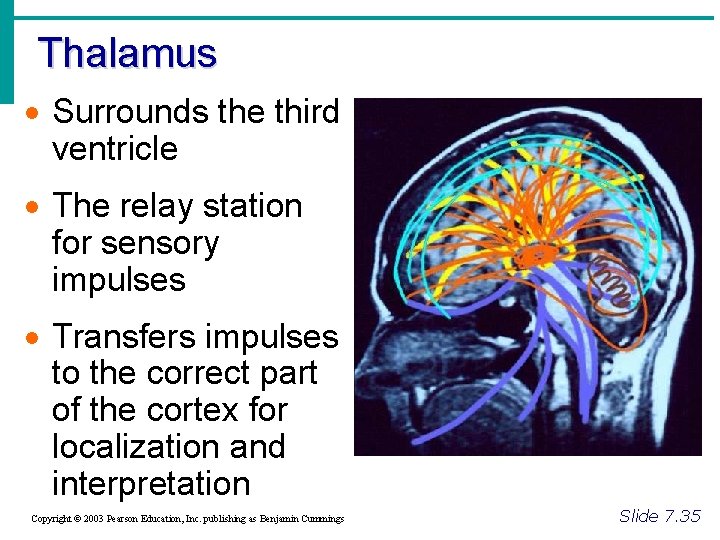 Thalamus · Surrounds the third ventricle · The relay station for sensory impulses ·