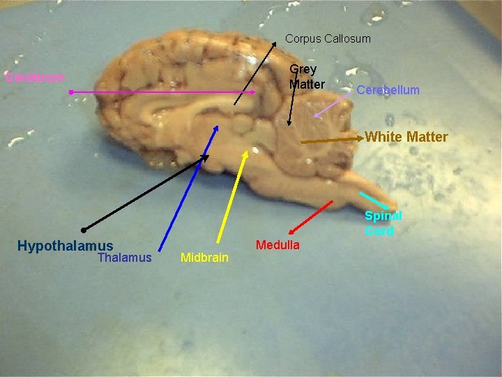 Corpus Callosum Grey Matter Cerebrum Cerebellum White Matter Spinal Cord Hypothalamus Thalamus Midbrain Medulla