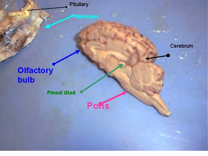 Pituitary Meninges Cerebrum Olfactory bulb Pineal Glad Pons 