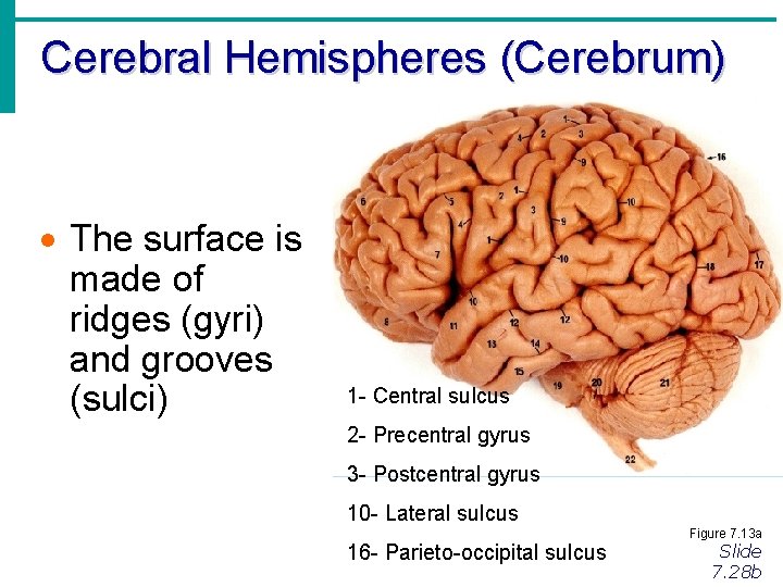 Cerebral Hemispheres (Cerebrum) · The surface is made of ridges (gyri) and grooves (sulci)