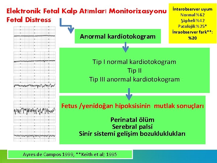 Elektronik Fetal Kalp Atımları Monitorizasyonu Fetal Distress Anormal kardiotokogram İnterobserver uyum Normal %62 Şüpheli