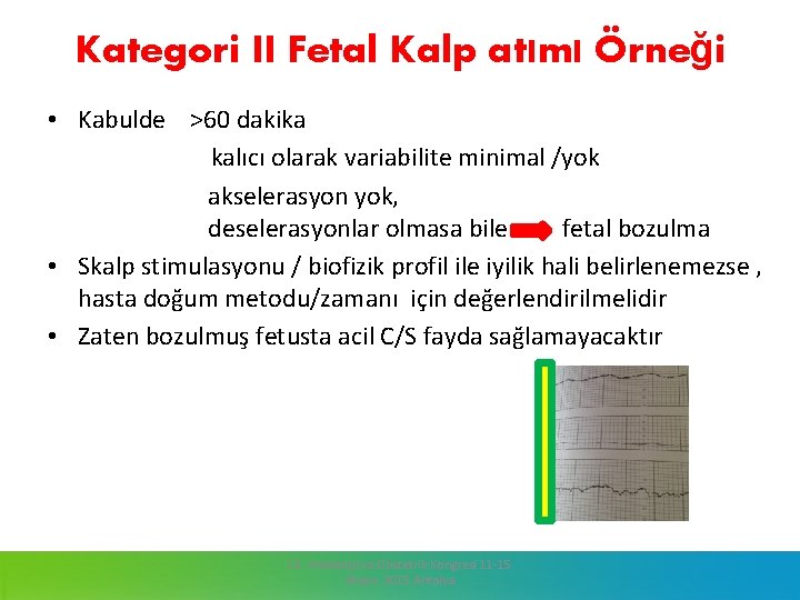 Kategori II Fetal Kalp atımı Örneği • Kabulde >60 dakika kalıcı olarak variabilite minimal