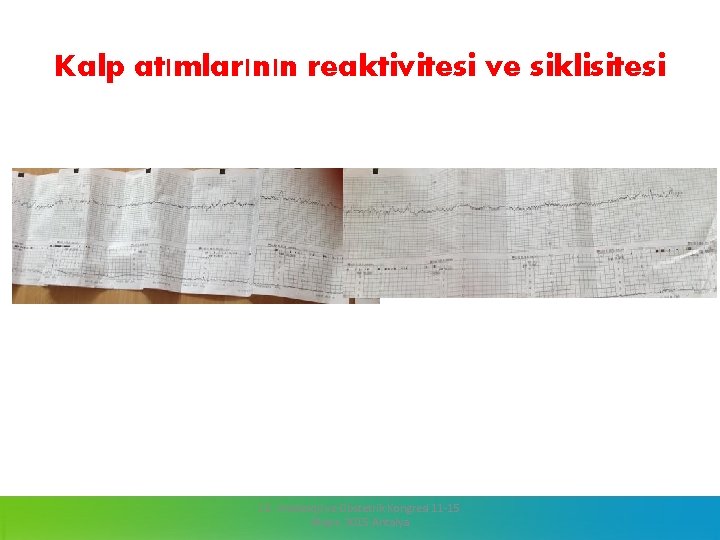 Kalp atımlarının reaktivitesi ve siklisitesi 13. Jinekoloji ve Obstetrik Kongresi 11 -15 Mayıs 2015