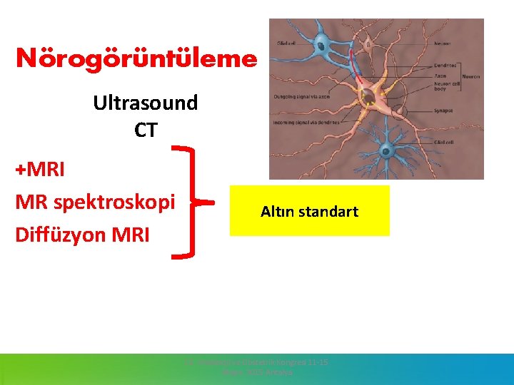 Nörogörüntüleme Ultrasound CT +MRI MR spektroskopi Diffüzyon MRI Altın standart 13. Jinekoloji ve Obstetrik