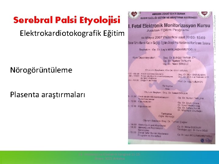 Serebral Palsi Etyolojisi Elektrokardiotokografik Eğitim Nörogörüntüleme Plasenta araştırmaları 13. Jinekoloji ve Obstetrik Kongresi 11