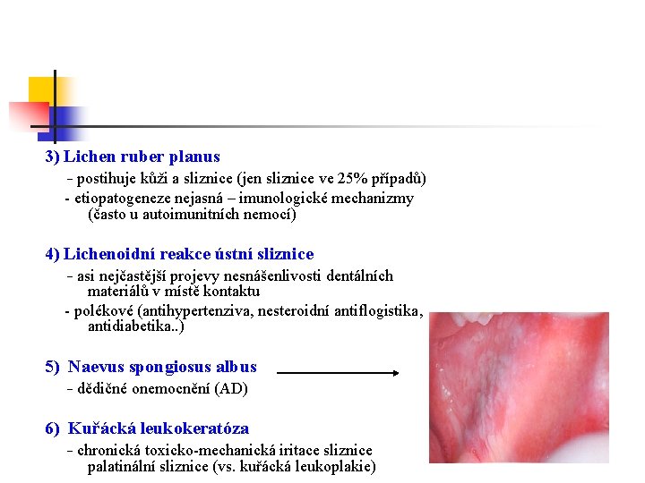 3) Lichen ruber planus - postihuje kůži a sliznice (jen sliznice ve 25% případů)