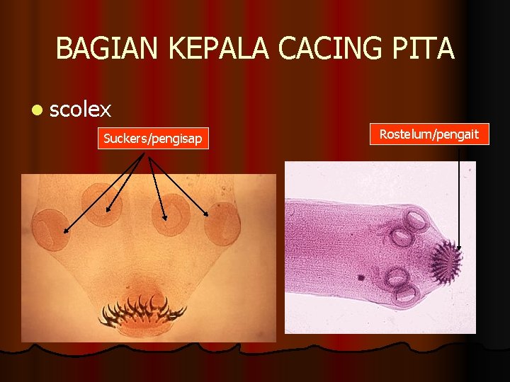 BAGIAN KEPALA CACING PITA l scolex Suckers/pengisap Rostelum/pengait 
