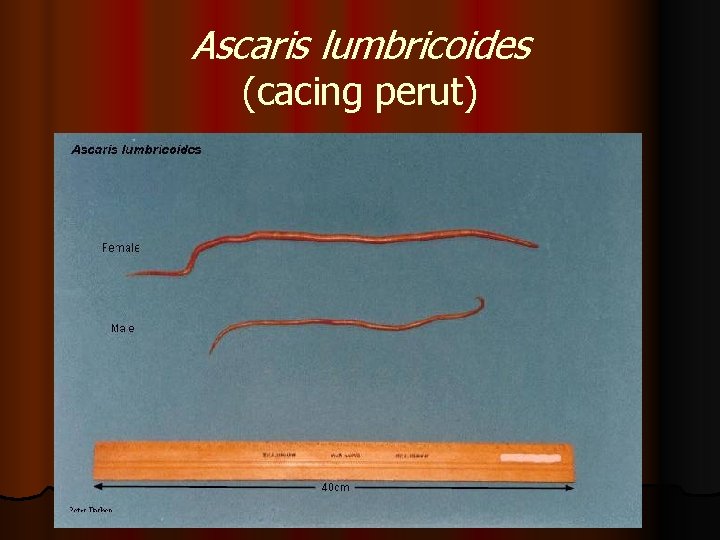 Ascaris lumbricoides (cacing perut) 