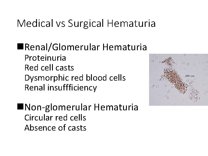 Medical vs Surgical Hematuria n. Renal/Glomerular Hematuria Proteinuria Red cell casts Dysmorphic red blood
