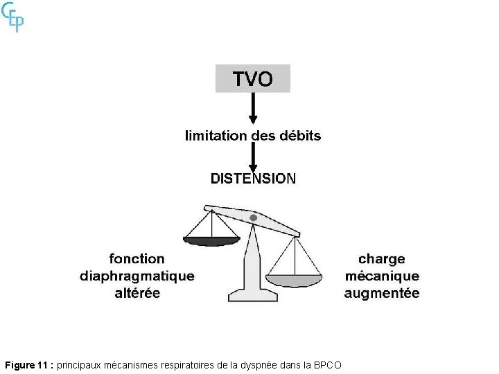 Figure 11 : principaux mécanismes respiratoires de la dyspnée dans la BPCO 