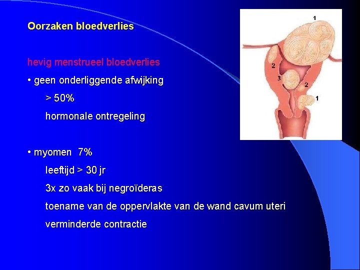 Oorzaken bloedverlies hevig menstrueel bloedverlies • geen onderliggende afwijking > 50% hormonale ontregeling •